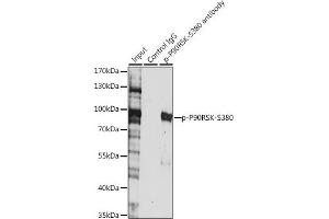 Immunoprecipitation analysis of 200 μg extracts of HeLa cells, using 3 μg Phospho-p90Rsk/RSK1/RPS6K-S380 pAb (ABIN6135275, ABIN6136172, ABIN6136173 and ABIN6225586). (RPS6KA1 抗体  (pSer380))