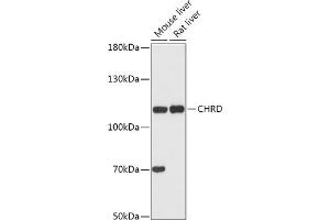 Western blot analysis of extracts of various cell lines, using CHRD antibody (ABIN7266350) at 1:1000 dilution. (Chordin 抗体  (AA 686-955))