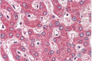 Immunohistochemistry (IHC) image for anti-Roundabout, Axon Guidance Receptor, Homolog 1 (ROBO1) (Internal Region) antibody (ABIN185537)