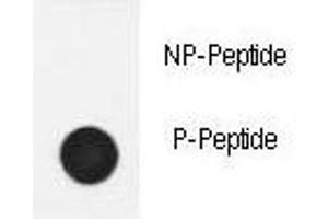 Dot Blot (DB) image for anti-Nephrosis 1, Congenital, Finnish Type (Nephrin) (NPHS1) (pTyr1210) antibody (ABIN3028865)