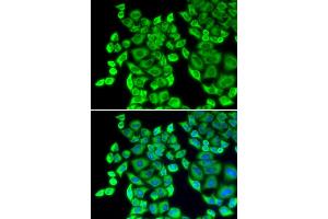 Immunofluorescence analysis of U2OS cells using EEF1D antibody (ABIN5971342). (EEF1D 抗体)