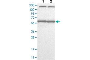 Western Blot analysis with KPNA6 polyclonal antibody  Lane 1: Human cell line RT-4 Lane 2: Human cell line U-251MG sp (KPNA6 抗体)