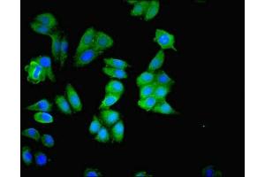 Immunofluorescence staining of HepG2 cells with ABIN7159999 at 1:200, counter-stained with DAPI. (ERK1 抗体  (AA 11-379))
