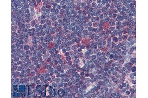 Immunohistochemistry staining of human thymus (paraffin sections) using anti-Cdk1 (clone POH-1). (CDK1 抗体)