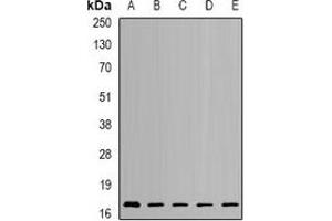 Western blot analysis of NUDT2 expression in SKOV3 (A), HL60 (B), mouse kidney (C), mouse brain (D), rat heart (E) whole cell lysates. (NUDT2 抗体)