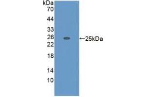 Detection of Recombinant ADAMTS7, Mouse using Polyclonal Antibody to A Disintegrin And Metalloproteinase With Thrombospondin 7 (ADAMTS7) (ADAMTS7 抗体  (AA 226-437))