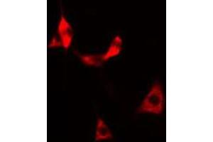 ABIN6269375 staining HeLa cells by IF/ICC. (DPYSL2 抗体  (C-Term))
