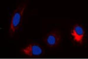 Immunofluorescent analysis of TAU (pS356) staining in Hela cells. (tau 抗体  (pSer356, pSer673))