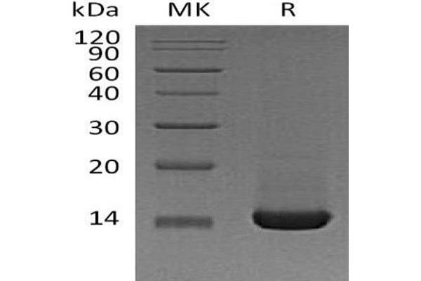 Trefoil Factor 2 Protein (TFF2) (His tag)