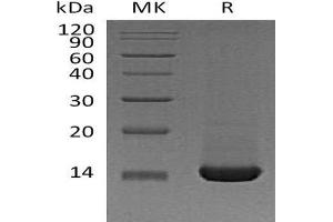 Western Blotting (WB) image for Trefoil Factor 2 (TFF2) protein (His tag) (ABIN7320765) (Trefoil Factor 2 Protein (TFF2) (His tag))