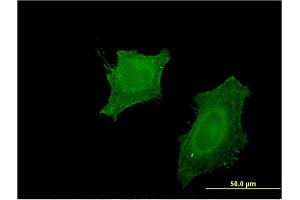 Immunofluorescence of monoclonal antibody to CNP on HeLa cell. (Cnpase 抗体  (AA 1-421))