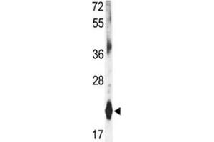 Western blot analysis of DHFR antibody and mouse liver tissue lysate (Dihydrofolate Reductase 抗体  (AA 135-164))