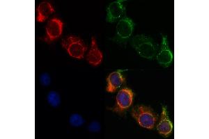 ABIN6263559 and ABIN6268825 staining HepG2 by IF/ICC. (NDUFA4 抗体  (C-Term))