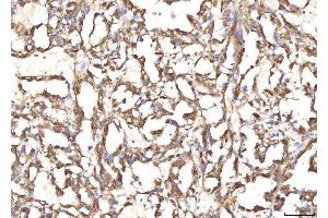 IHC analysis of BHMT using anti-BHMT antibody (ABIN7599940). (BHMT 抗体  (AA 13-386))