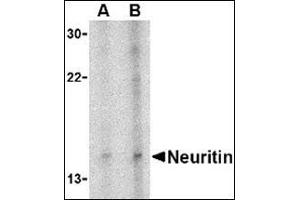 Western blot analysis of neuritin in Daudi cell lysate with this product at (A) 5 and (B) 10 μg/ml. (NRN1 抗体  (Center))