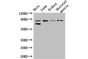 Western Blot Positive WB detected in: Hela whole cell lysate, Mouse lung tissue, Mouse kidney tissue, Mouse skeletal muscle tissue All lanes: PRDM4 antibody at 3. (PRDM4 抗体  (AA 301-500))