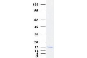 Western Blotting (WB) image for SH2 Domain Containing 1A (SH2D1A) (Transcript Variant 1) protein (Myc-DYKDDDDK Tag) (ABIN2731954)