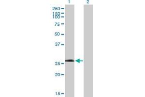Western Blot analysis of LRRK1 expression in transfected 293T cell line by LRRK1 MaxPab polyclonal antibody. (LRRK1 抗体  (AA 1-261))