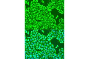 Immunofluorescence analysis of U2OS cells using TUBB8 antibody. (Tubulin, beta 8 抗体)