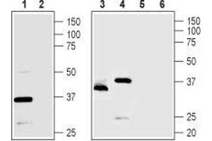 Western blot analysis of rat pancreas (lanes 1 and 2), Mouse MS1 endothelial cells (lanes 3 and 5) and human PANC1 pancreatic carcinoma cells (lanes 4 and 6) lysates: - 1,3,4. (TMEM66 抗体  (Intracellular, Lumenal Region))
