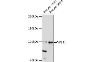 Western blot analysis of extracts of various cell lines, using VPS11 Rabbit mAb (ABIN7271272) at 1:1000 dilution. (VPS11 抗体)