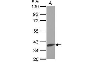 Western Blotting (WB) image for anti-Solute Carrier Family 25 (Mitochondrial Carrier, Citrate Transporter), Member 1 (Slc25a1) (Center) antibody (ABIN2855315)
