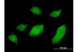 Immunofluorescence of monoclonal antibody to UBQLN1 on HeLa cell. (Ubiquilin 1 抗体  (AA 1-589))