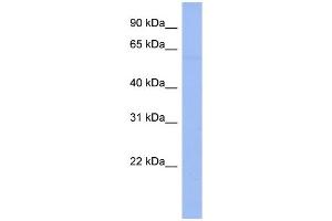WB Suggested Anti-DTX1 Antibody Titration:  0. (Deltex Homolog 1 抗体  (N-Term))
