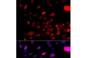 Immunofluorescence analysis of U2OS cells using Phospho-CHEK1(S317) Polyclonal Antibody (CHEK1 抗体  (pSer317))