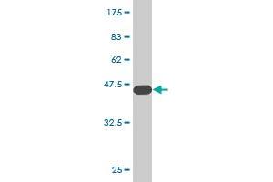 Western Blot detection against Immunogen (43. (CGB5 抗体  (AA 1-165))