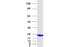Western Blotting (WB) image for 3-hydroxybutyrate Dehydrogenase, Type 2 (BDH2) protein (Myc-DYKDDDDK Tag) (ABIN2715214)
