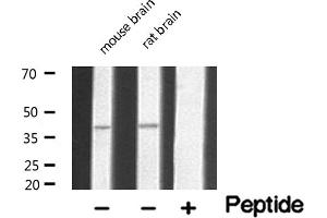 Western blot analysis of extracts of various tissue sample,using 5-HT-5A Antibody . (Serotonin Receptor 5A 抗体  (Internal Region))