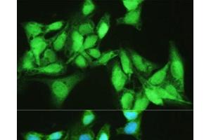 Immunofluorescence analysis of U2OS cells using KDM7A Polyclonal Antibody at dilution of 1:100. (JHDM1D 抗体)