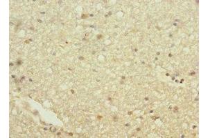 Immunohistochemistry of paraffin-embedded human brain tissue using ABIN7154932 at dilution of 1:100 (HHIP 抗体  (AA 18-220))