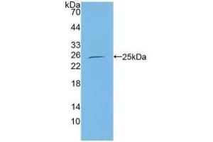Detection of Recombinant CBFb, Human using Polyclonal Antibody to Core Binding Factor Beta Subunit (CBFb)
