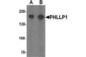 Western blot analysis of PHLPP1 in SW480 cell lysate with PHLPP1 Antibody  at (A) 1 and (B) 2 μg/ml. (PHLPP1 抗体  (N-Term))