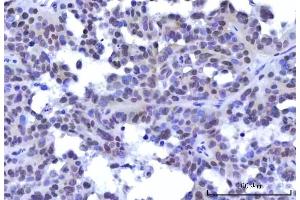IHC analysis of RBM15B using anti-RBM15B antibody (ABIN7600219). (RBM15B 抗体  (AA 164-890))