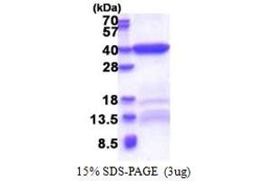 BEN Domain Containing 6 (BEND6) (AA 1-279) protein (His tag)