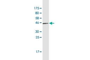 Western Blotting (WB) image for anti-Ferritin, Light Polypeptide (FTL) (AA 1-175) antibody (ABIN947883)