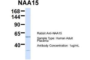 Host:  Rabbit  Target Name:  NAA15  Sample Type:  Human Adult Placenta  Antibody Dilution:  1. (NAA15 抗体  (N-Term))