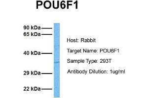 Host: Rabbit Target Name: POU6F1 Sample Tissue: Human 293T Antibody Dilution: 1. (POU6F1 抗体  (Middle Region))