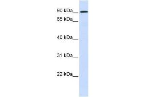 HKR1 antibody used at 1. (HKR1 抗体  (N-Term))