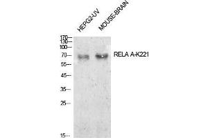 Western Blot (WB) analysis of HepG2-UV, Mouse Brain cells using Acetyl-NFkappaB-p65 (K221) Polyclonal Antibody.