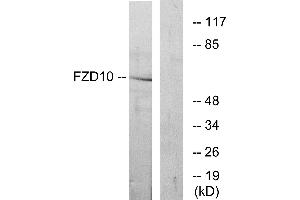 Western blot analysis of extracts from COS-7 cells, using FZD10 antibody. (FZD10 抗体  (Internal Region))