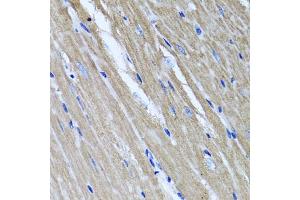 Immunohistochemistry of paraffin-embedded mouse heart using TNFAIP6 antibody (ABIN5975410) at dilution of 1/100 (40x lens). (TNFAIP6 抗体)