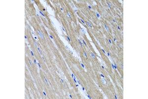 Immunohistochemistry of paraffin-embedded mouse heart using TNFAIP6 antibody (ABIN5975410) at dilution of 1/100 (40x lens). (TNFAIP6 抗体)