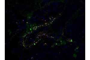 Co-expression of SARS-CoV-2 (COVID-19) Envelope and C5b-9 in Human Lung Tissue from the COVID-19 Patient: Immunofluorescent l analysis of paraffin-embedded COVID-19 patient lung tissue using anti- SARS-CoV-2 (COVID-19) Envelope antibody (ABIN1031551, 2 μg/mL, red) and anti-C5b-9 antibody (green). (SARS-CoV-2 Envelope 抗体  (N-Term))