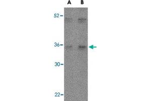 Western blot analysis of IL27 in Daudi lysate with IL27 polyclonal antibody  at (A) 2 and (B) 4 ug/mL . (IL-27 抗体  (Internal Region))