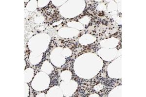 Immunohistochemical staining (Formalin-fixed paraffin-embedded sections) of human bone marrow with ZNF192 polyclonal antibody  shows strong nuclear positivity in bone marrow poietic cells. (ZNF192 抗体)