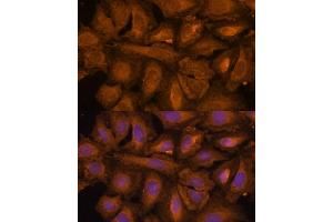 Immunofluorescence analysis of U-2 OS cells using STUB1 Polyclonal Antibody (ABIN6129459, ABIN6148649, ABIN6148650 and ABIN6215447) at dilution of 1:100 (40x lens). (STUB1 抗体  (AA 1-303))